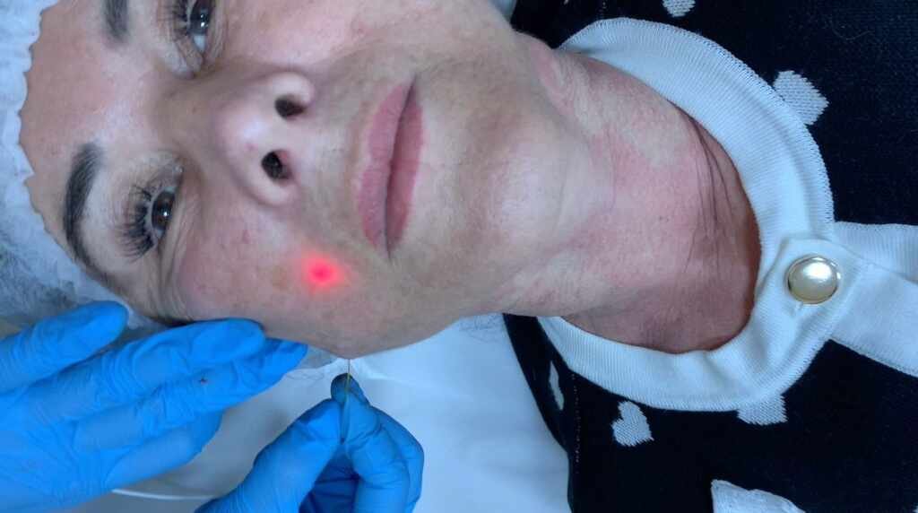 Clínica Bella Mooca: Um Marco de Inovação em Estética Avançada em São Paulo Clínica Bella Mooca: Um Marco de Inovação em Estética Avançada em São Paulo