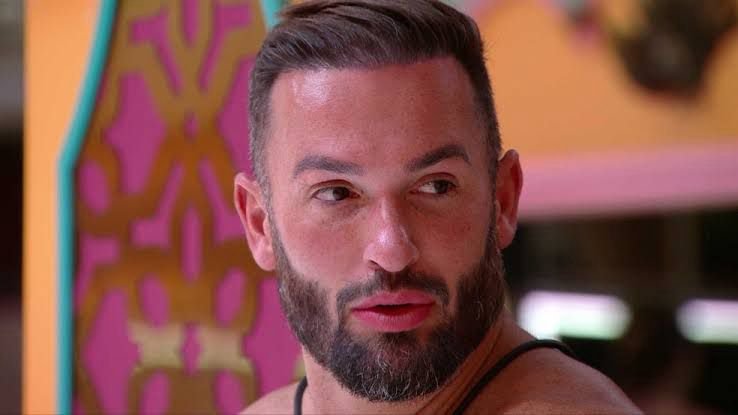 Diego Hypolito fez transplante capilar antes do BBB 25; médico revela detalhes Diego Hypolito fez transplante capilar antes do BBB 25; médico revela detalhes