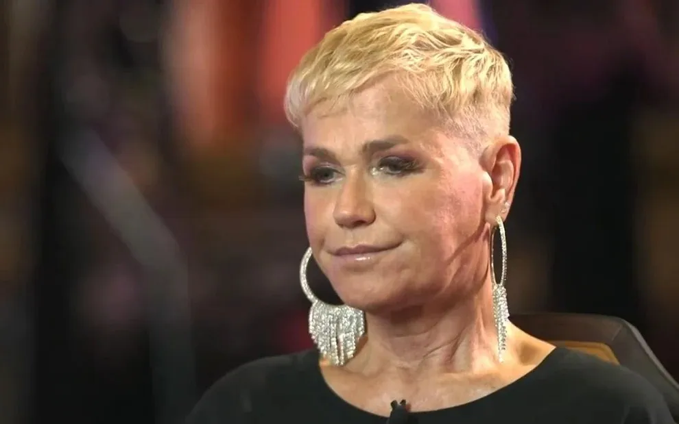 Xuxa Meneghel faz transplante capilar e surpreende público Xuxa Meneghel faz transplante capilar e surpreende público