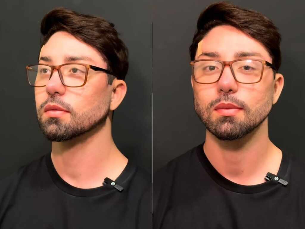Rico Melquiades é barrado na imigração em Dubai após procedimentos estéticos