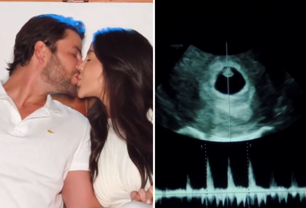Laís Caldas e Gustavo Marsengo anunciam gravidez do primeiro filho após casamento Laís Caldas e Gustavo Marsengo anunciam gravidez do primeiro filho após casamento