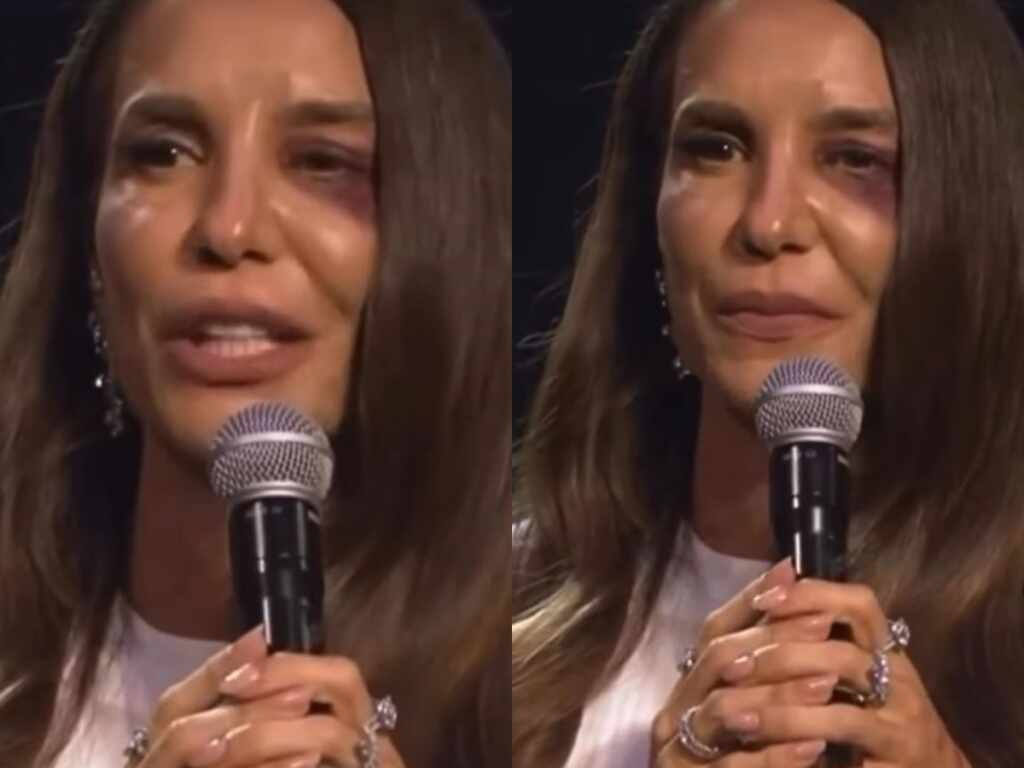 Ivete Sangalo confirma que passará por cirurgia neste domingo Ivete Sangalo confirma que passará por cirurgia neste domingo