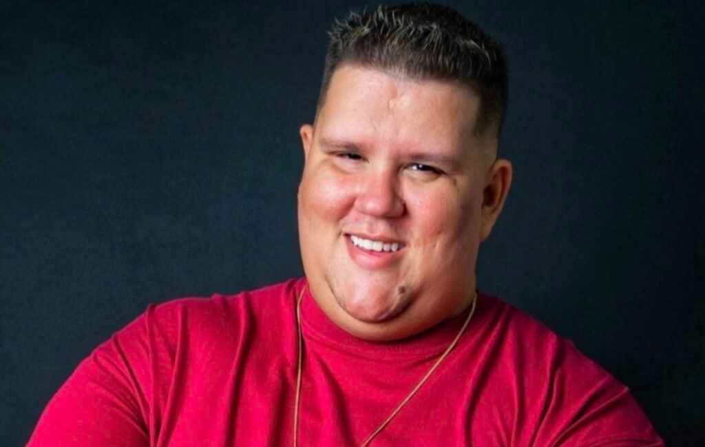 Desanexadas